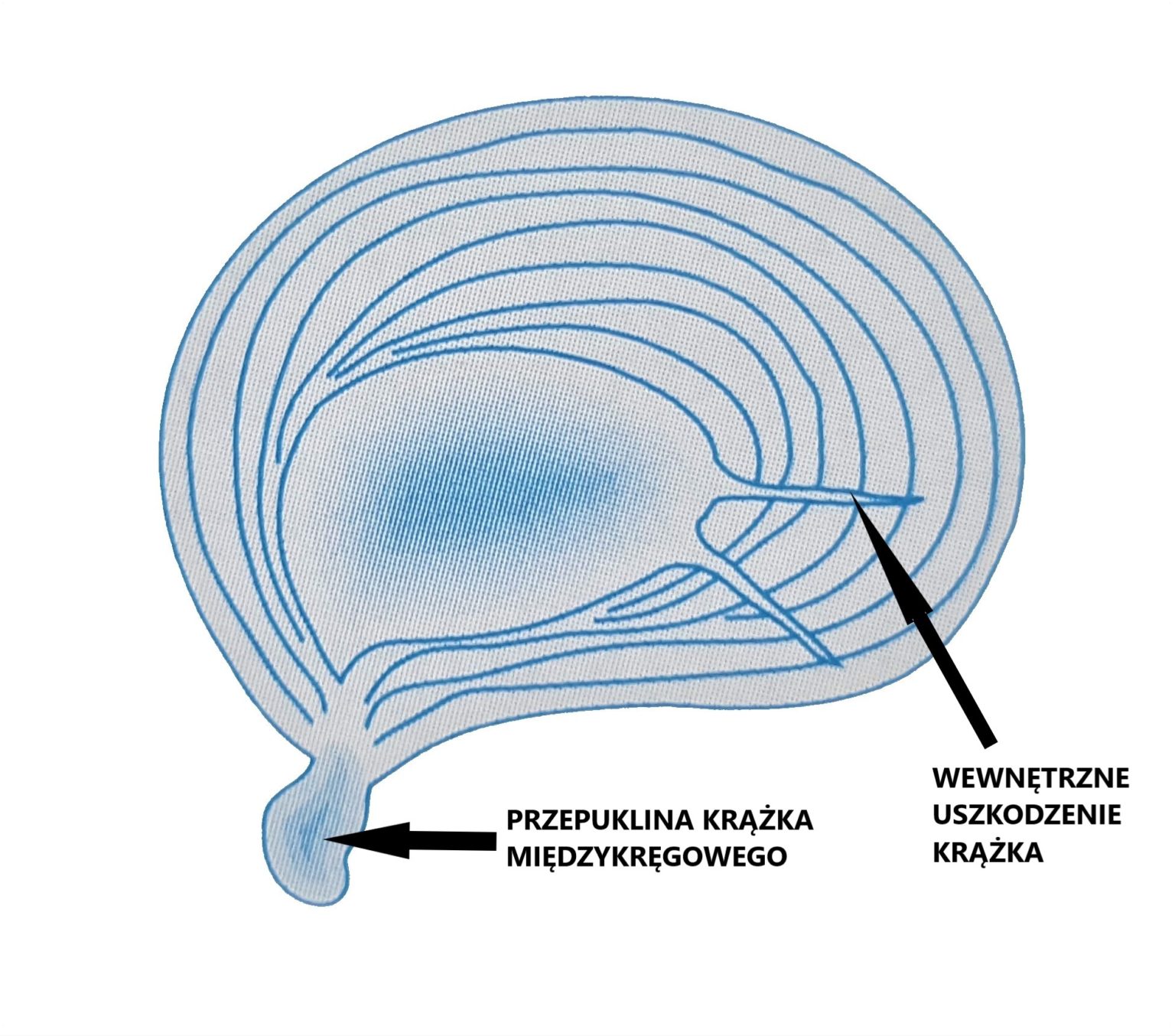 krążek strktura ekstruzja 1536x1354